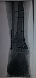 lrankle.jpg