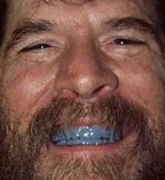 BlueTeeth.jpg