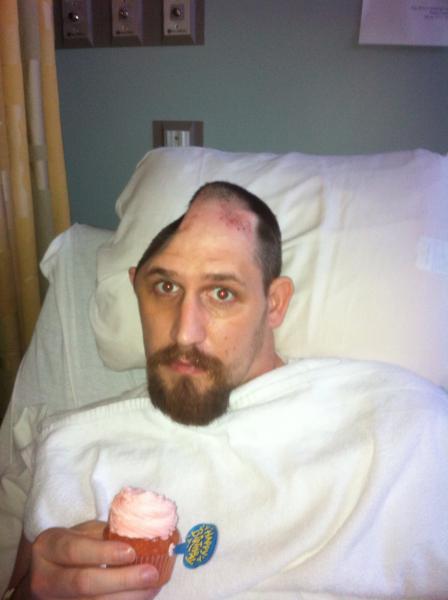 2012TBI (traumatic brain injury) fyi I was worse than this! (This was months into my recovery)Almost didn't make 33! & now have a spyder to enjoy. THA