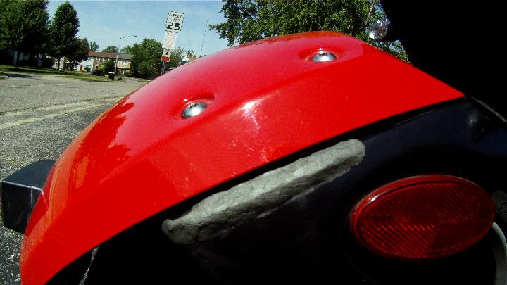 Right side after pix